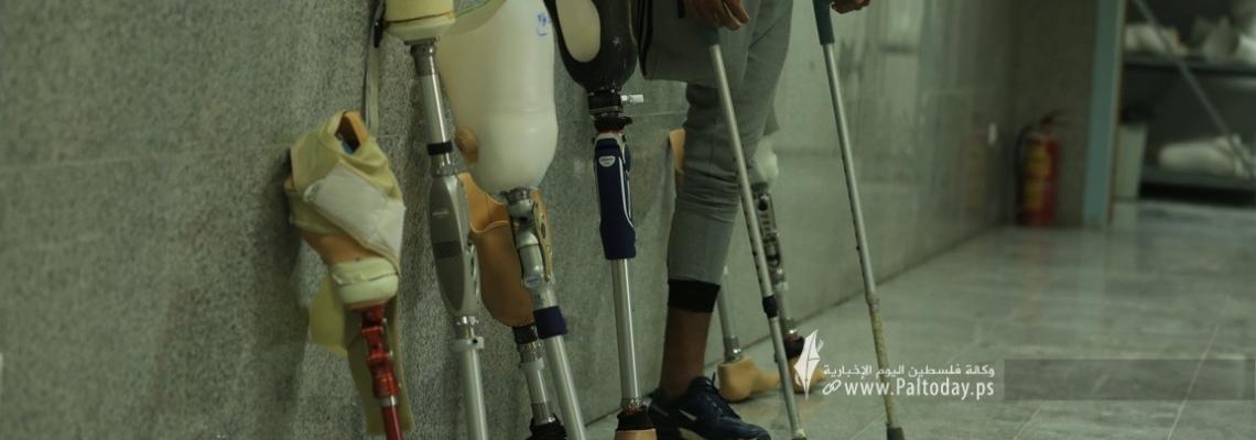 مركز الأطراف الصناعية بمشفى حمد بمدينة غزة