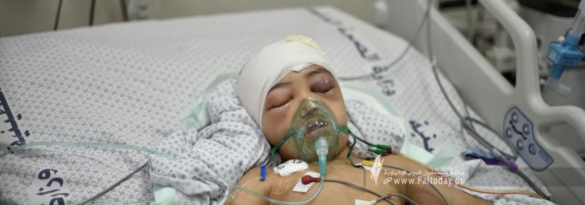 بالصور : أطفال غزة الجرحى ضحايا القصف الإسرائيلي المستمر