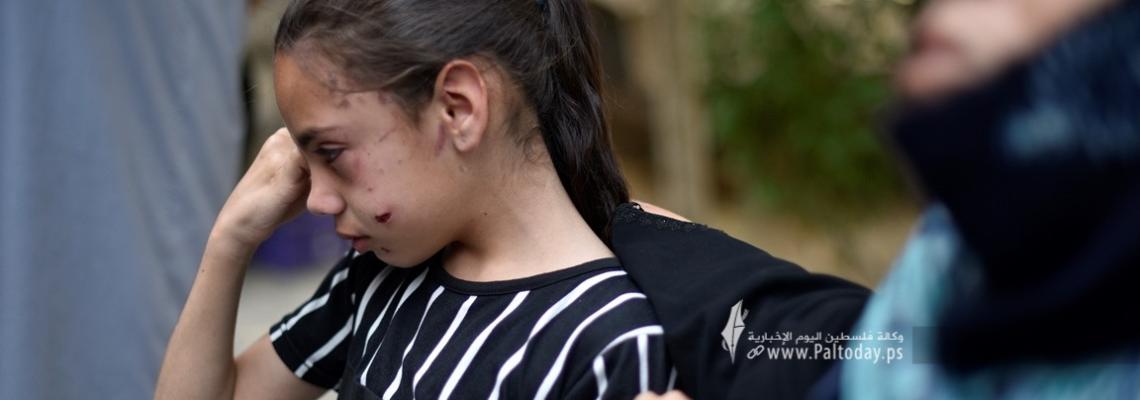 قصة مصورة : الطفلة " تالا " الناجية الوحيدة من المجزرة التي ارتكبها الاحتلال بحق عائلتها الذين ارتقوا جميعم، بعد تدمير المنزل كاملا عليهم شرق مدينة خانيونس.