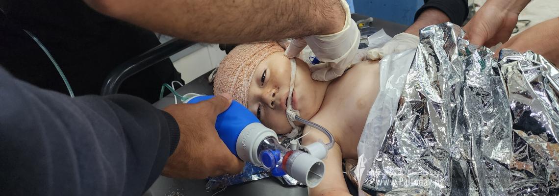 إصابات اطفال في قصف منزل عائلة ابو شمالة جنوب قطاع غزة