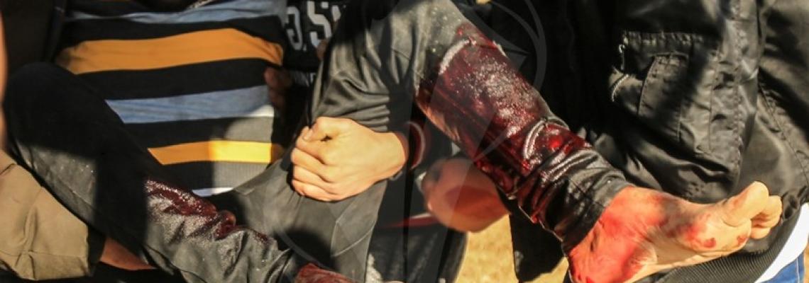 اندلاع مواجهات على حدود غزة في اليوم المئة على قرار ترامب