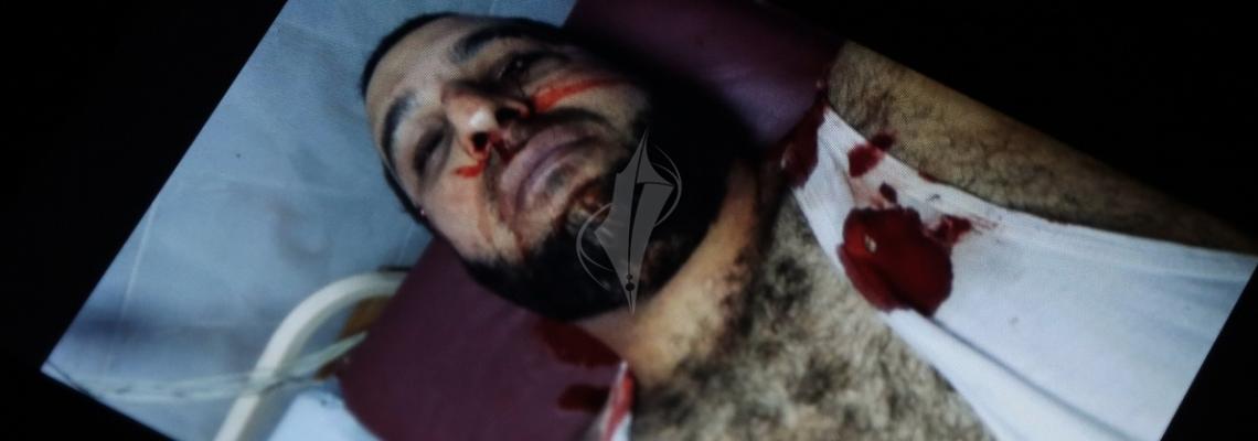 صور :أولية لجريمة اغتيال الاسير المحرر مازن فقهاء