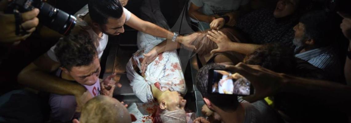 شهيدان واصابات في مجمع الشفاء الطبي غرب غزة