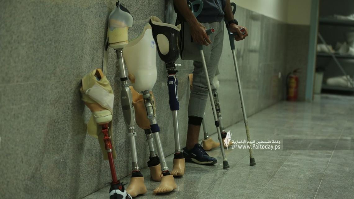 مركز الأطراف الصناعية بمشفى حمد بمدينة غزة