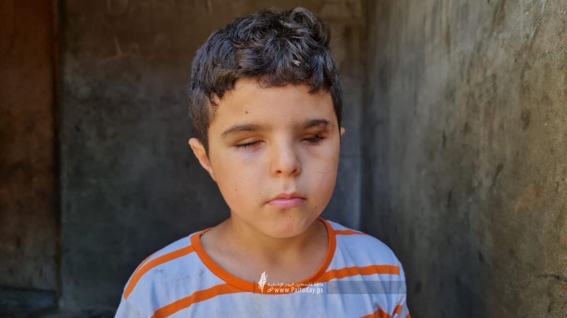 الطالب محمد شعبان من بيت لاهيا يُحرم من العودة لمدرسته بعد أن فقد بصره خلال العدوان الأخير