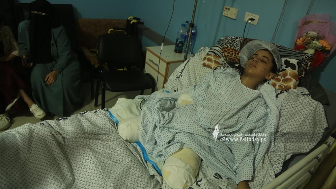 بالصور: رهف سلمان.. طفلة أفقدها العدو "الإسرائيلي" أطرافها الثلاثة في مجزرة جديدة ارتكبها في مخيم جباليا أسفرت عن استشهاد 7 شهداء أطفال و35 جريحًا