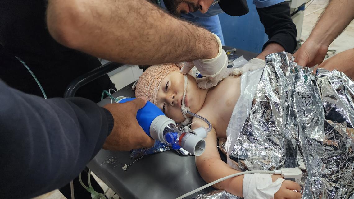 إصابات اطفال في قصف منزل عائلة ابو شمالة جنوب قطاع غزة