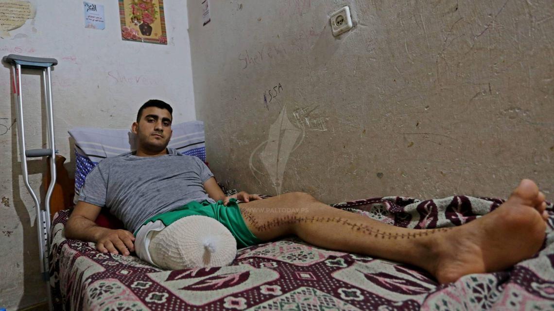 علاء الدالي لاعب دراجات هوائية كان سيشارك في بطولة آسيا لهذا العام فقد ساقه برصاص الاحتلال على حدود القطاع