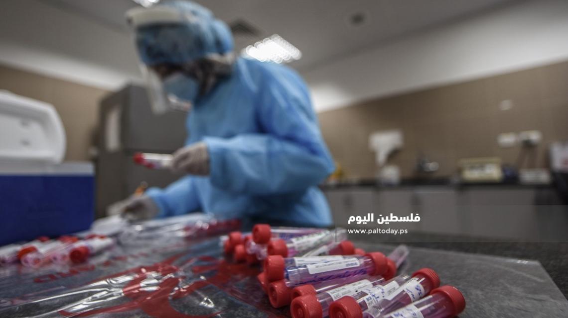 تجهيز عينات فحص كورونا داخل مختبر مستشفى ناصر فى مدينة خانيونس