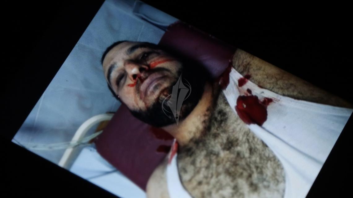 صور :أولية لجريمة اغتيال الاسير المحرر مازن فقهاء
