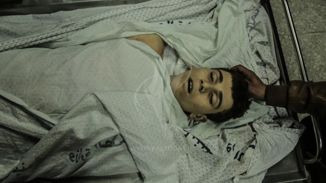 وداع الشهيد الفتى محمد الداية في مستشفى الشفاء استشهد متاثرا باصابته شرق غزة