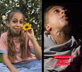 الطفلة راما