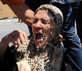 الثورة تصل شوارع تركيا
