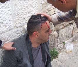 القدس تنتفض في يوم الأرض واعتقالات وإصابات واسعة..!