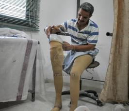 صناعة الاطراف الصناعية