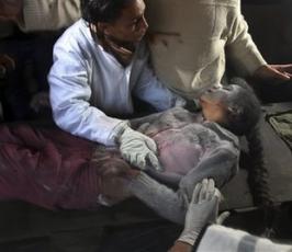بالصور ... مجازر بحق الأطفال والمدنيين في غزة 