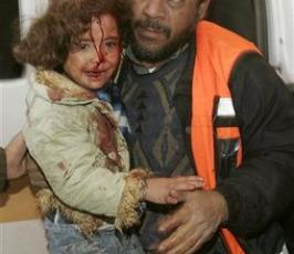 بالصور ... مجازر بحق الأطفال والمدنيين في غزة 