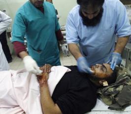 بالصور: إصابات فى قصف جوى صهيونى بجنوب قطاع غزة