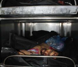 بالصور : جثماني الشهيدين جراء العدوان الصهيوني  شمال قطاع غزة 