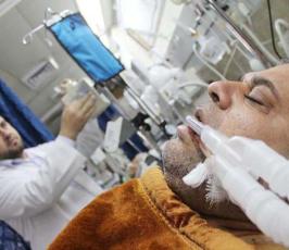 بالصور : عدسة « فلسطين اليوم » تتجول في قسمي القلب والعظام بمستشفى الشفاء