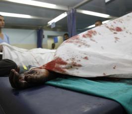 بالصور.. العدوان الصهيوني يحصد مزيداً من الشهداء والجرحى من بينهم نساء وأطفال