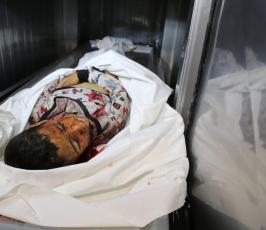 عدسةفلسطين اليوم خلال 2016 ‫(38011424)‬ ‫‬