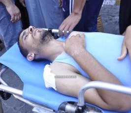 شهداء وجرحى 2104