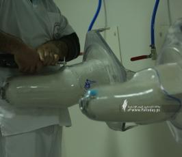 مركز الأطراف الصناعية (13)