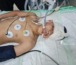 فتى يتلقى العلاج بعد قصف الاحتلال الاسرائيلي على منازل المدنيين بغزة