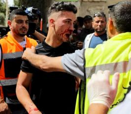 إصابات المسجد الأقصى (6)