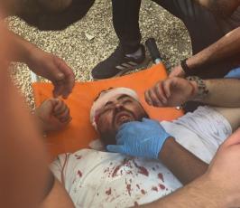 مواجهات عنيفة في المسجد الأقصى (14)