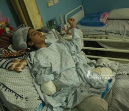 الطفلة رهف يداي وقدماي سبقتني إلى الجنة (2)