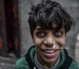 كفيف (12)