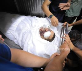 الاستعداد لتشيع جثامين شهداء الامس من داخل مجمع الشفاء..