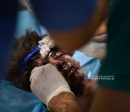 طوفان الاقصى (5)