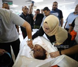  الزميل الصحفي في قناة فلسطين اليوم محمد بعلوشة جراء قصف اسرائيلي استهدف منزله  شمال غزة (4)