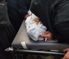 شهداء خانيونس في مستشفى ناصر (13)