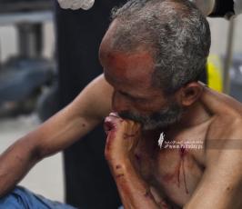 جرحى وصلوا مجمع ناصر الطبي منذ صباح اليوم (3)