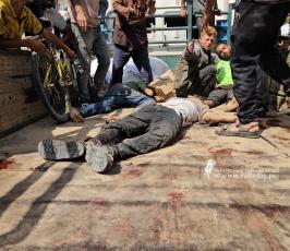 جرحى وصلوا مجمع ناصر الطبي منذ صباح اليوم (5)