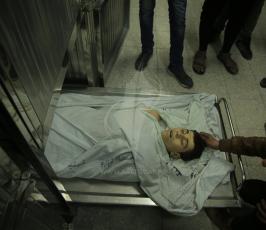 شهيد الفتى محمد الداية في مستشفى الشفاء استشهد متاثرا باصابته شرق غزة ‫(43057667)‬ ‫‬.JPG