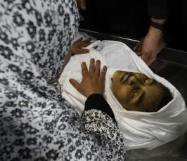 صور للطفل الشهيد ايوب العسلى بمستشفى كمال عدوان