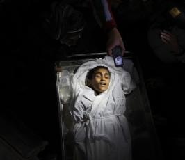 صور للطفل الشهيد ايوب العسلى بمستشفى كمال عدوان