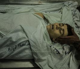 شهيد الفتى محمد الداية في مستشفى الشفاء استشهد متاثرا باصابته شرق غزة ‫(43057669)‬ ‫‬.JPG
