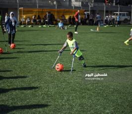 اطفال مبتورين  ‫(178603269)‬ ‫‬.jpg