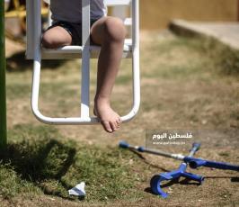 اطفال مبتورين ‫(327589956)‬ ‫‬.jpg