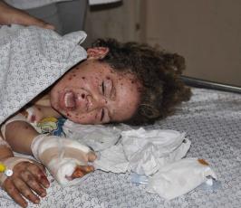 شهداء وجرحى في غارة على سيارة مدنية في بلدة بني سهيلا شرق خانيونس‏