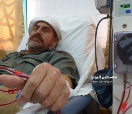 مرضى الكلي (3).jpeg