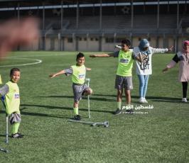 اطفال مبتورين  ‫(178603280)‬ ‫‬.jpg