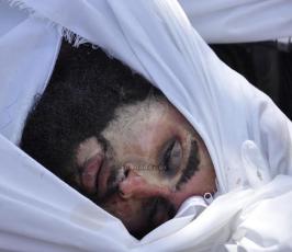 جرحى وشهداء2014
