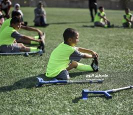 اطفال مبتورين  ‫(178603279)‬ ‫‬.jpg